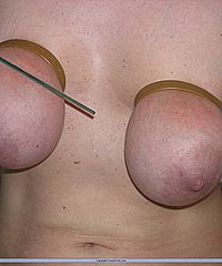 Amateurs Bdsm And Needle Pain