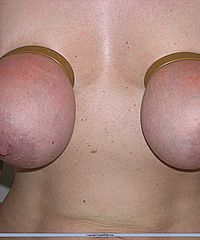 Amateurs Bdsm And Needle Pain