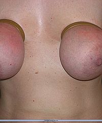 Amateurs Bdsm And Needle Pain